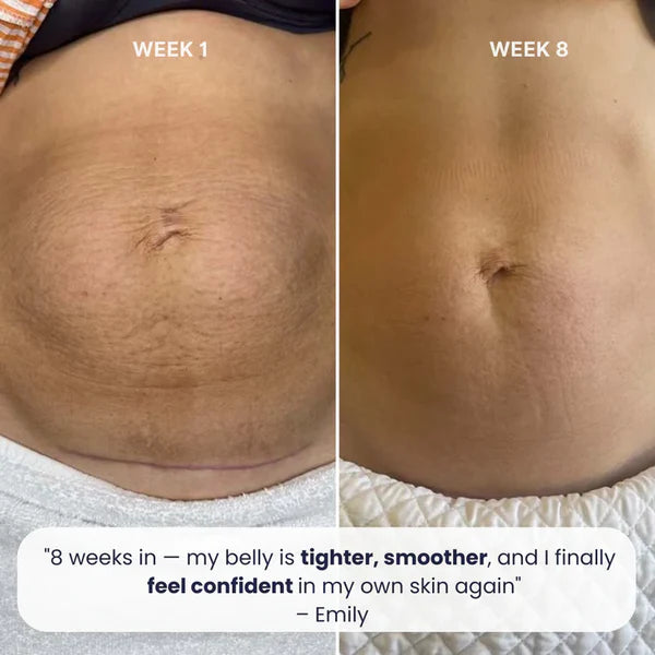 Body Contouring Belt & Red Light Therapy Kit